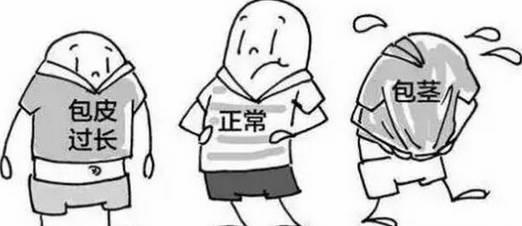 男性包皮过长注意事项有哪些呢
